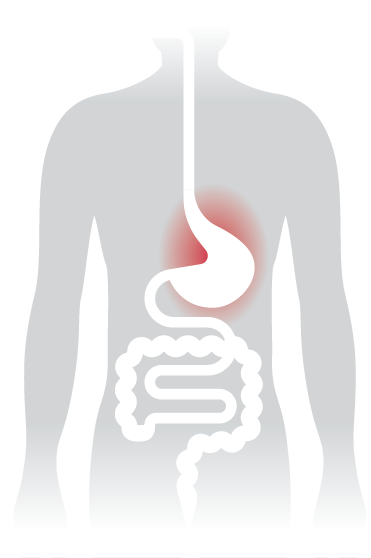 Burning - Urea Breath Test (371x558), Png Download