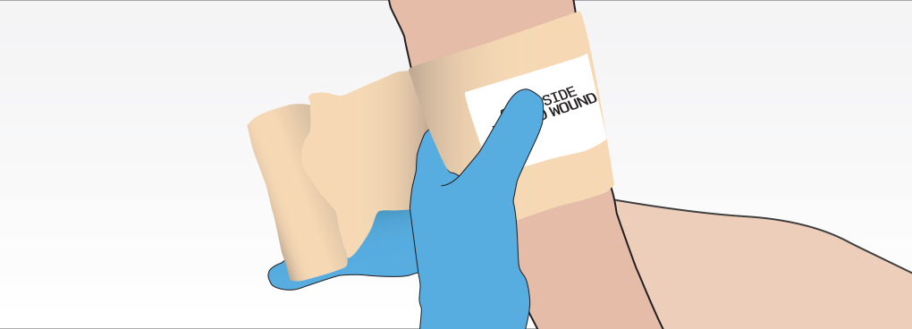 Secure The Bandage Using The Clips (1020x368), Png Download