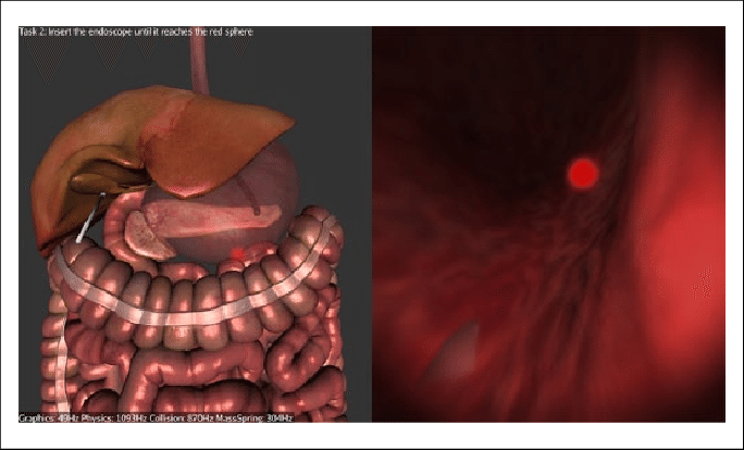 Navigating Inside The Stomach - Stomach (684x414), Png Download