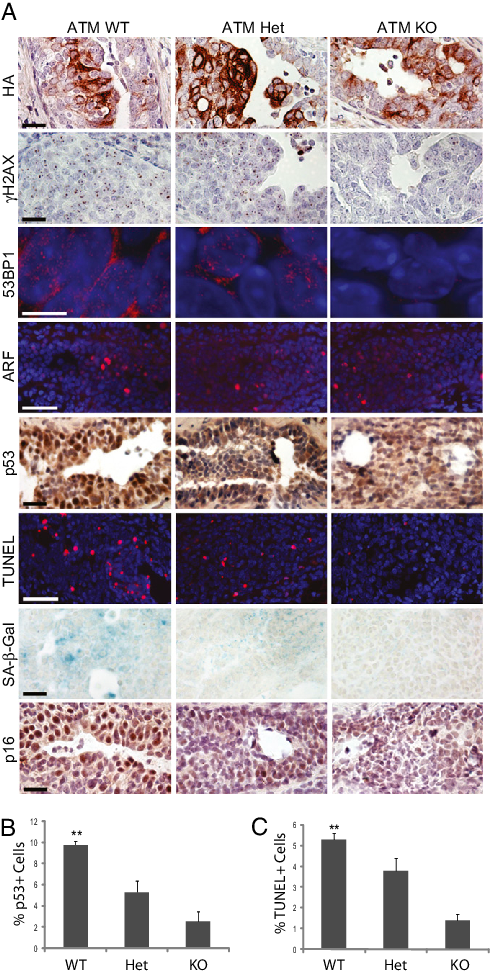 Atm Ablation Results In Reduced Ddr Signaling, Apoptosis, (490x974), Png Download