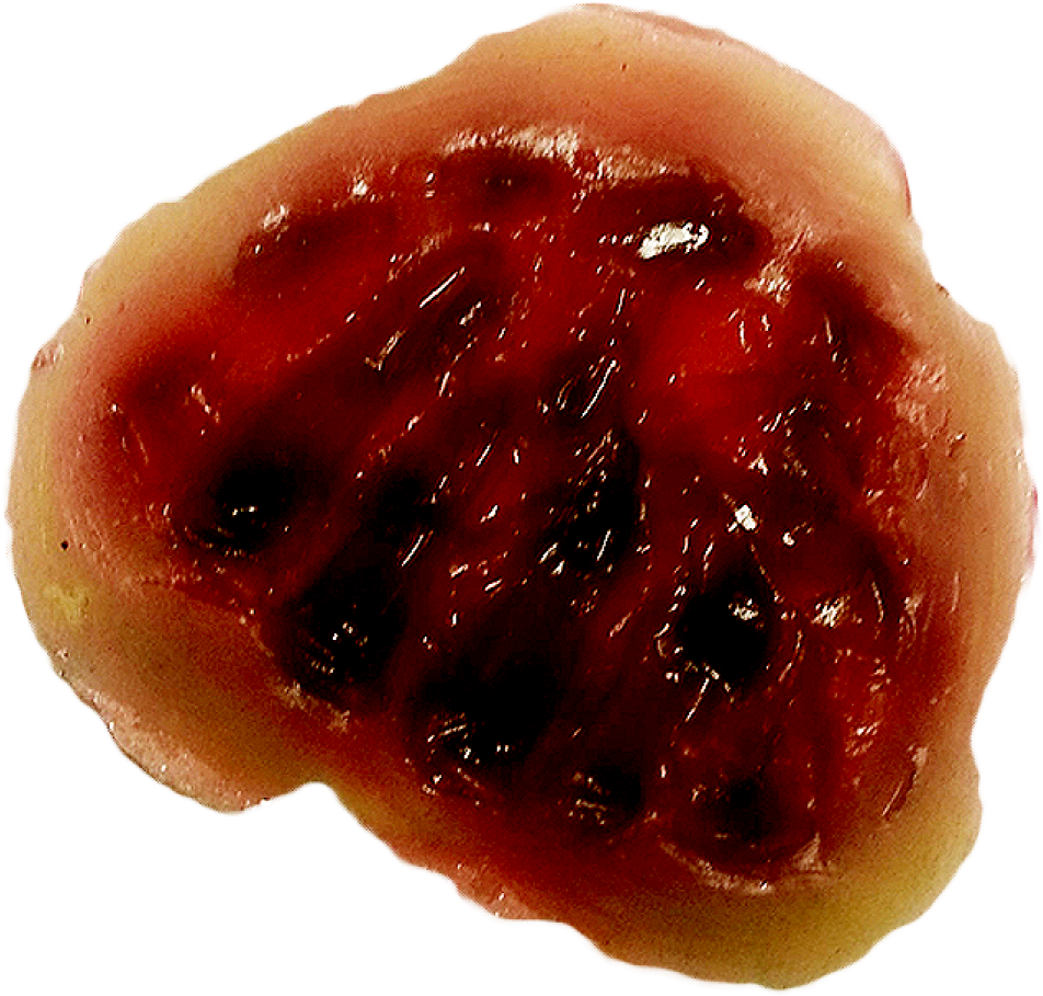 Bite Prosthetic Sfx (1200x1200), Png Download