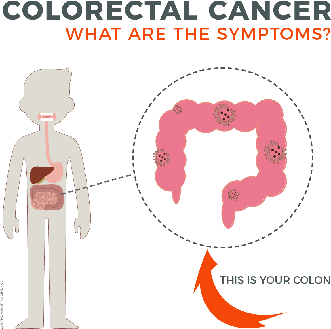 Symptoms Of Colorectal Cancer, The Body's Digestive - Cartoon (1340x1340), Png Download