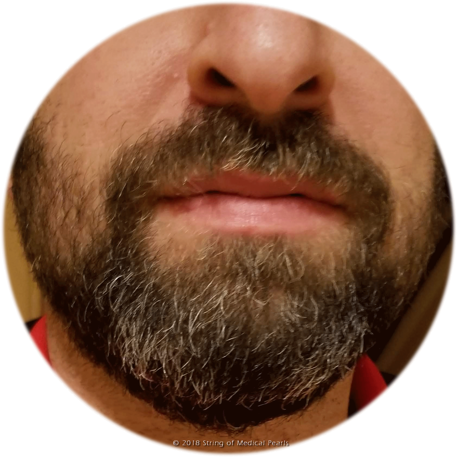 Is This A Reason To Grow A Beard - Close-up (1600x1600), Png Download