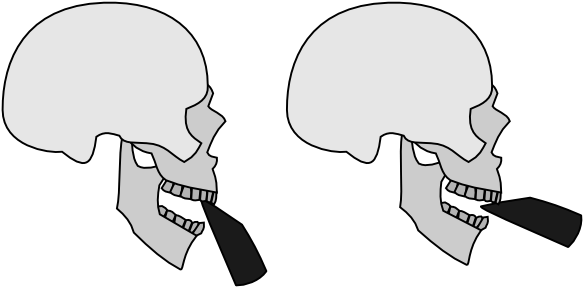 Clarinet And Saxophone Embouchures And The “chin” - Proper Embouchure For Saxophone (600x304), Png Download