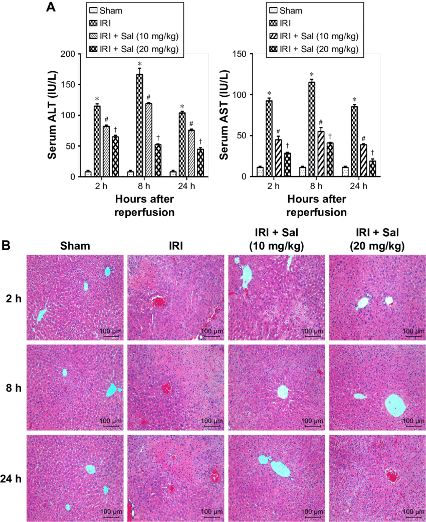 Effects Of Sal On The Liver Function And Histopathology - Diagram (850x1041), Png Download