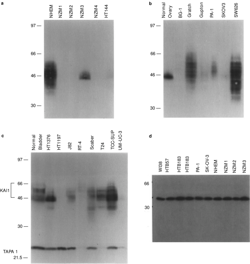 Western Blot Analysis Of Normal Cells And Carcinoma - Reflection (850x895), Png Download