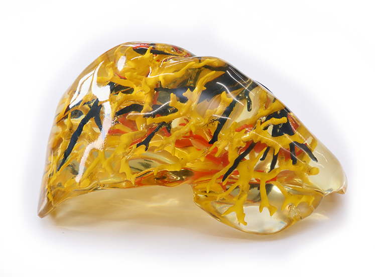 Possible To Create Heart & Organ Models For Individual - Amber (747x552), Png Download