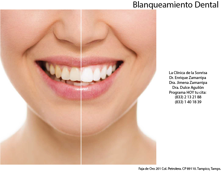 Save To Collection - Much Is Teeth Whitening (762x591), Png Download