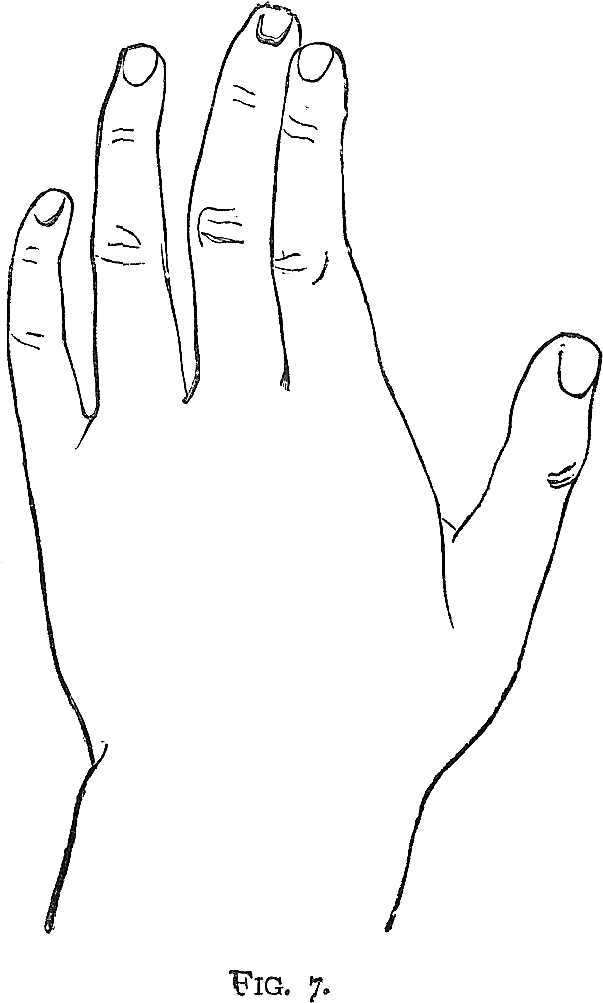 Hand (790x1185), Png Download