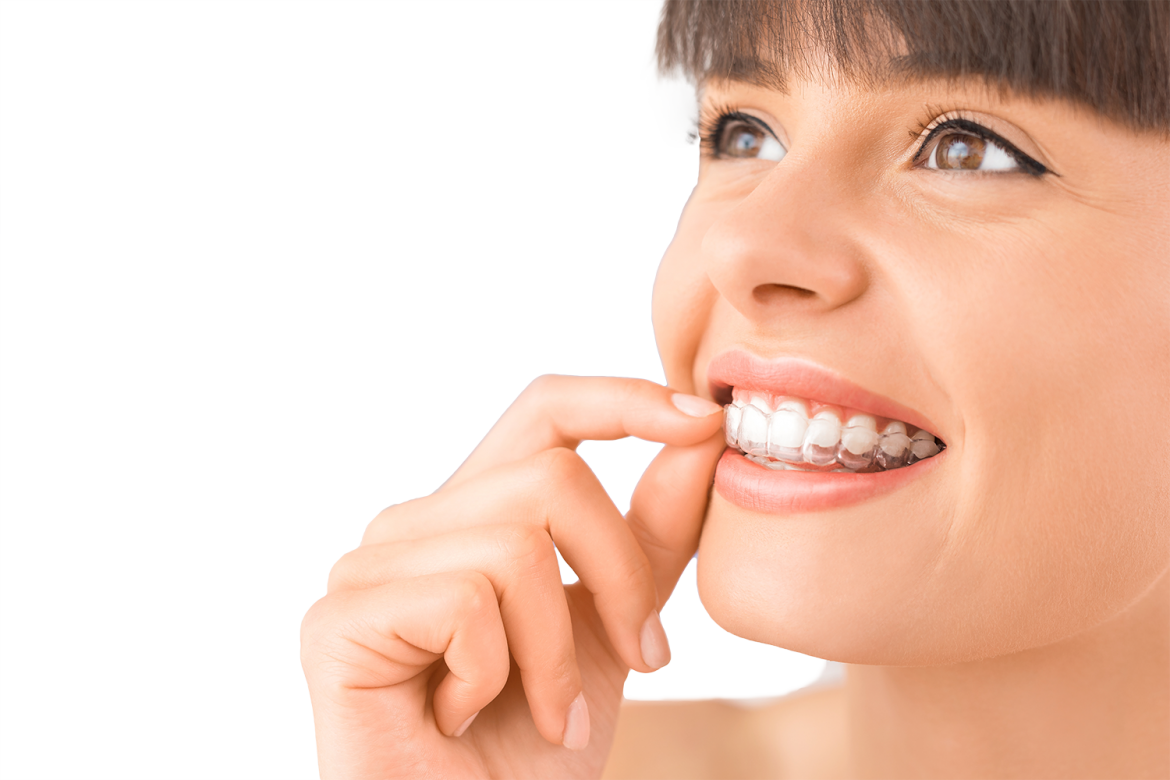 Invisalign-girl - Invisalign Smile (1170x780), Png Download