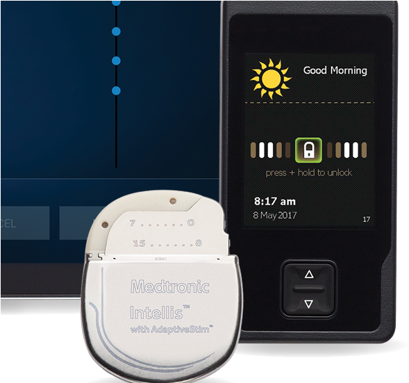 Medtronic Announces Fda Approval And U (654x550), Png Download