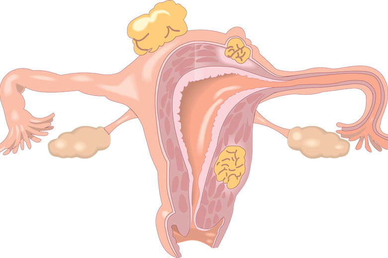 Have You Had Your Vital Cervical Smear Test - Women Body Parts In Hindi (780x520), Png Download