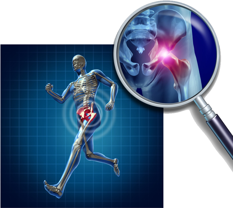 Emu Oil And Sciatica - Joint Bone (800x732), Png Download