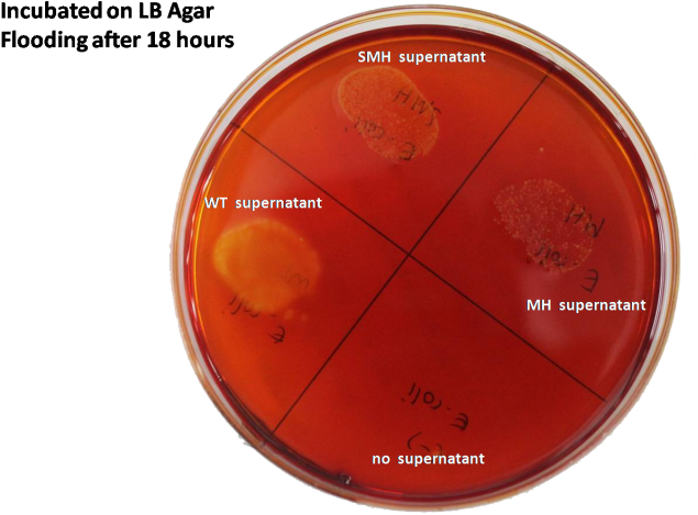 800px-starch3 " " - Pseudomonas Aeruginosa Amylase Test (800x534), Png Download