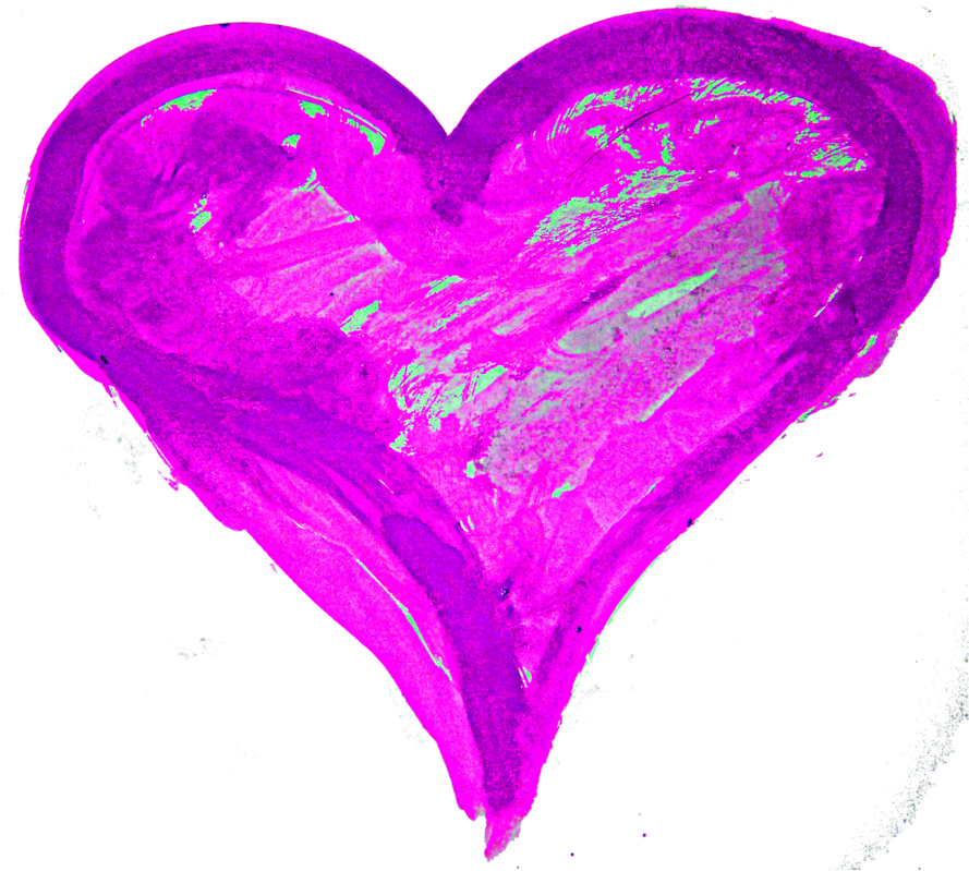 Hand Paintedwatercolor Heart Png - Watercolour Heart Png Blue (1024x1024), Png Download