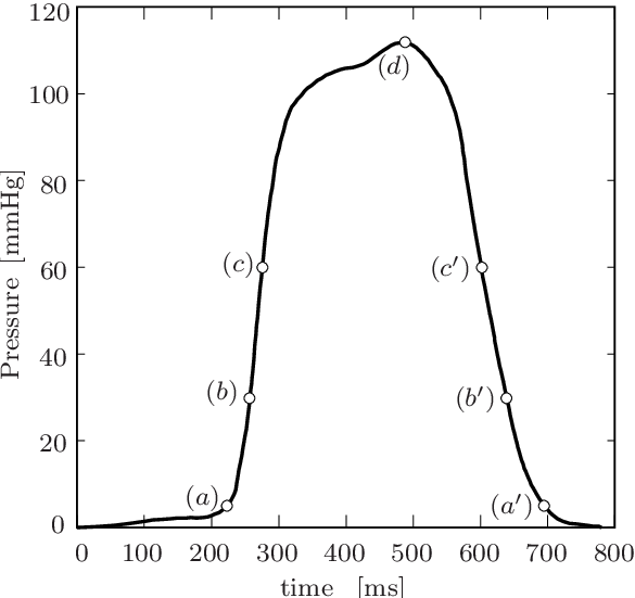 Loading Curve Of Lv - Line Art (585x551), Png Download