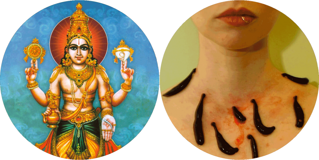 Leech Treatment Then And Now - Leeches Meaning In Hindi (1024x513), Png Download