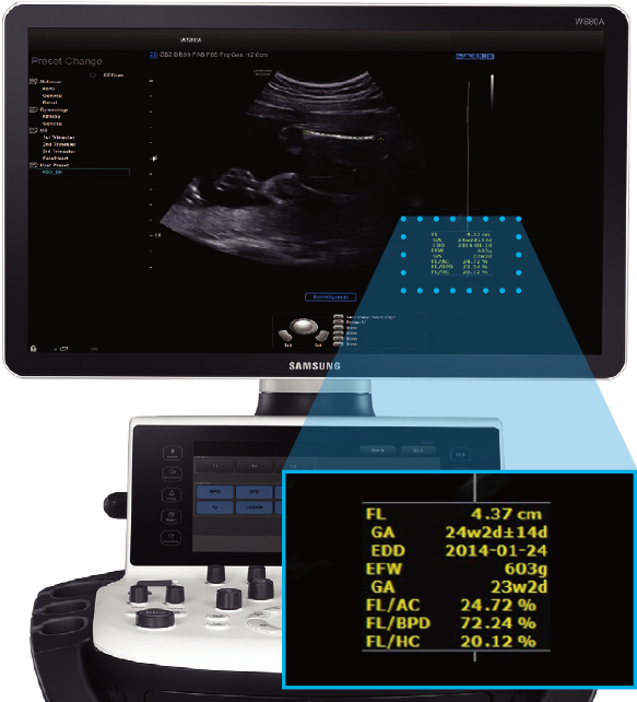 Hycosy In Ceus Hycosy In Ceus - Biometry Assist (688x641), Png Download