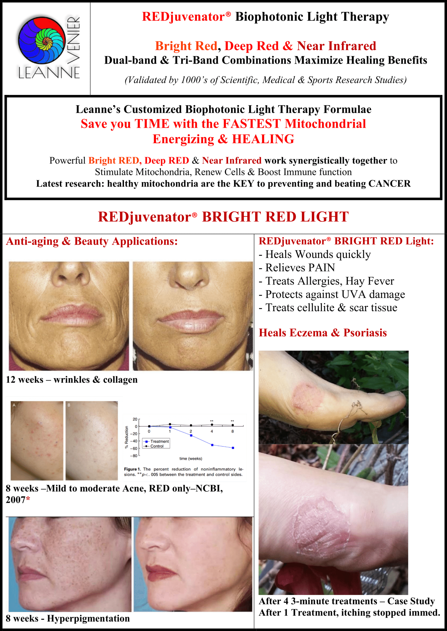 Leave A Reply Cancel Reply - Lipstick (1453x2048), Png Download