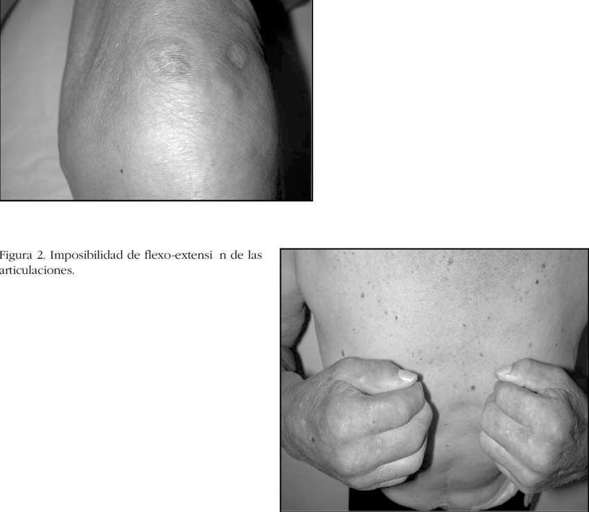 Placa De Borde Irregular Y Proyecciones Ameboideas - Monochrome (850x738), Png Download