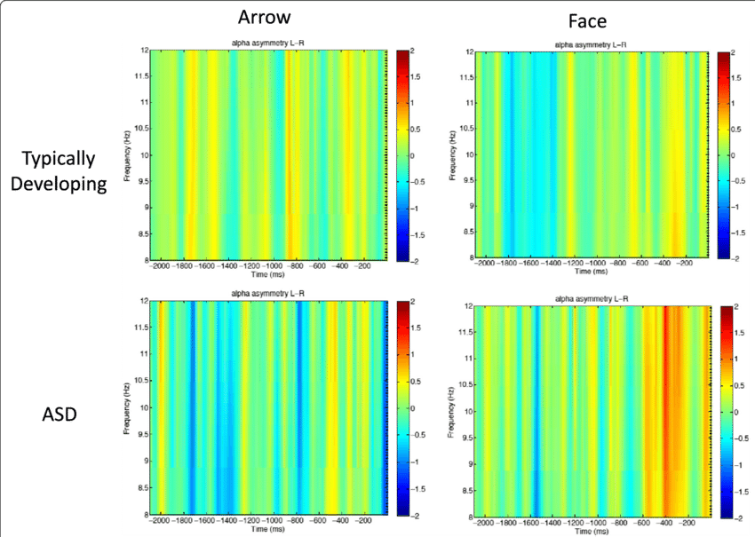 Anticipatory Alpha Asymmetry In Temporal Electrode - Style (850x605), Png Download