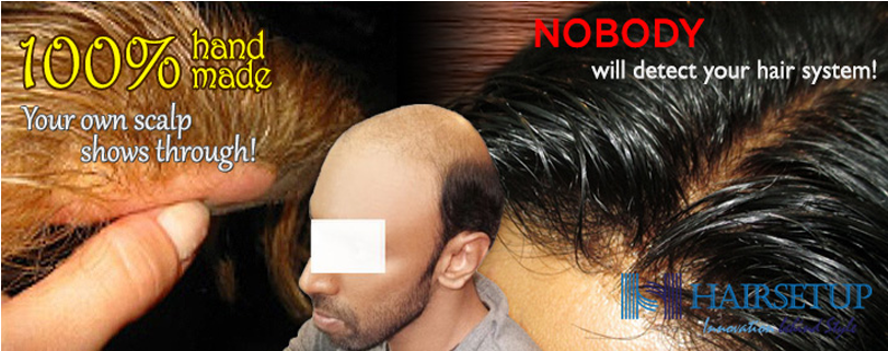 Your Hair Replacement System Is Tailored To Fit - Lace Wig (1140x445), Png Download