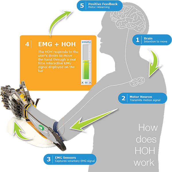 Hand Of Hope Via Rehab-robotics - Robot And Sensors Rehabilitation (600x602), Png Download