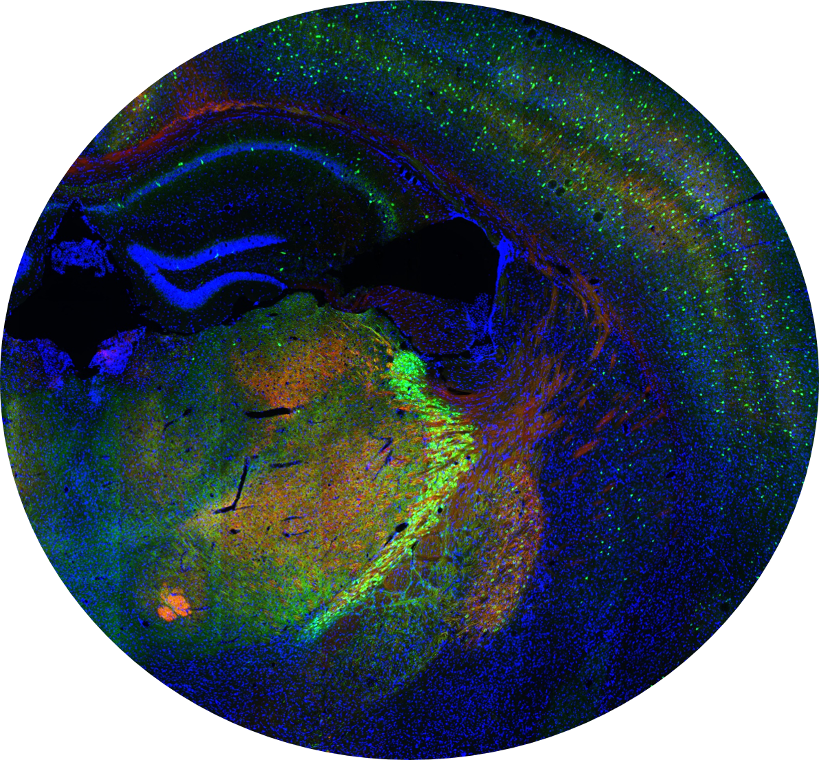 One Of Four Images Exemplifying Allen Institute Data - Allen Institute Mouse Brain (1192x1105), Png Download