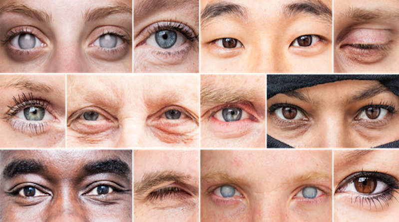Five Possible Ways To Look A Person In The Face During - Blind People Eyes (799x445), Png Download