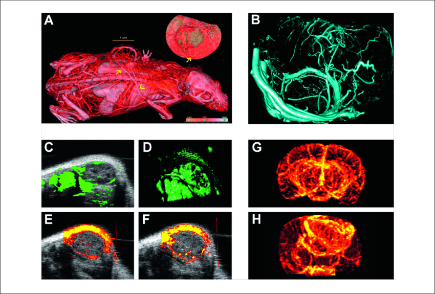 Micro-morphological Imaging Of Tumour Angiogenesis - Graphic Design (850x575), Png Download