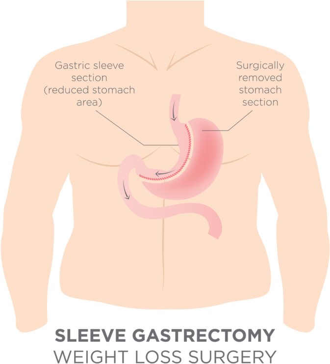 The Sphincter Or Pyloric Valve Remains Intact With - Obama Lied The Economy Died (768x768), Png Download