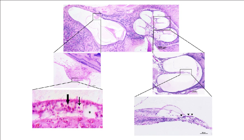 Thin Arrow = Type 1 Vestibular Hair Cell - Sketch (850x490), Png Download