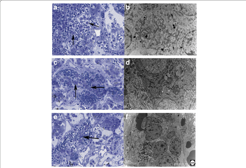 Ctcs In Three Cases Were Shown - Tile (850x581), Png Download