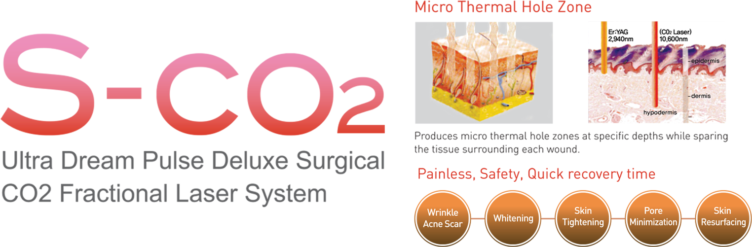 Laser > Vagina Laser > Sco2 Fractional Vaginal - Graphic Design (2000x550), Png Download