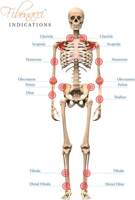 Fb-indications - Esqueleto Humano Por Detrás (1000x674), Png Download