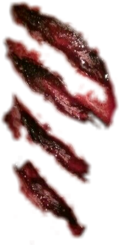 Cut Wound Png Full Size Png Download Seekpng