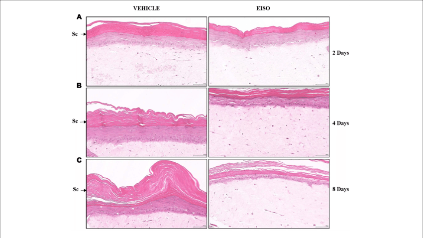 East Indian Sandalwood Oil Treatment Restores Epidermal - Illustration (850x478), Png Download