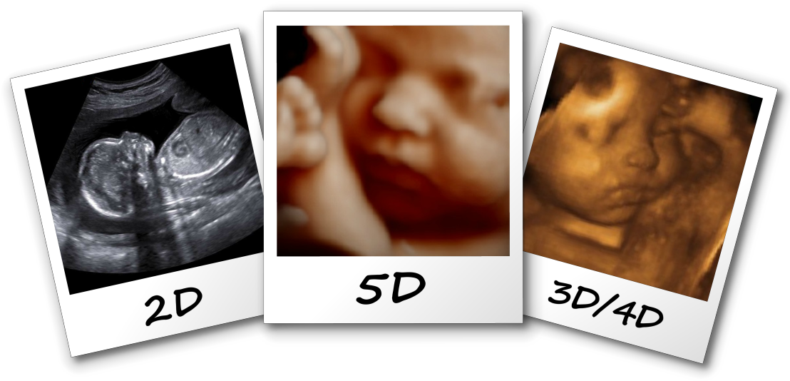 3d/4d/5d Ultrasound Fayetteville Nc Comparison Image - 3d 4d 5d Ultrasound (1115x541), Png Download