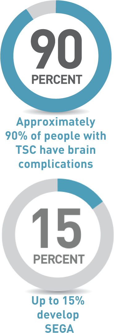 Segas Usually Develop During Childhood But They Can - Accent Jobs (480x1090), Png Download