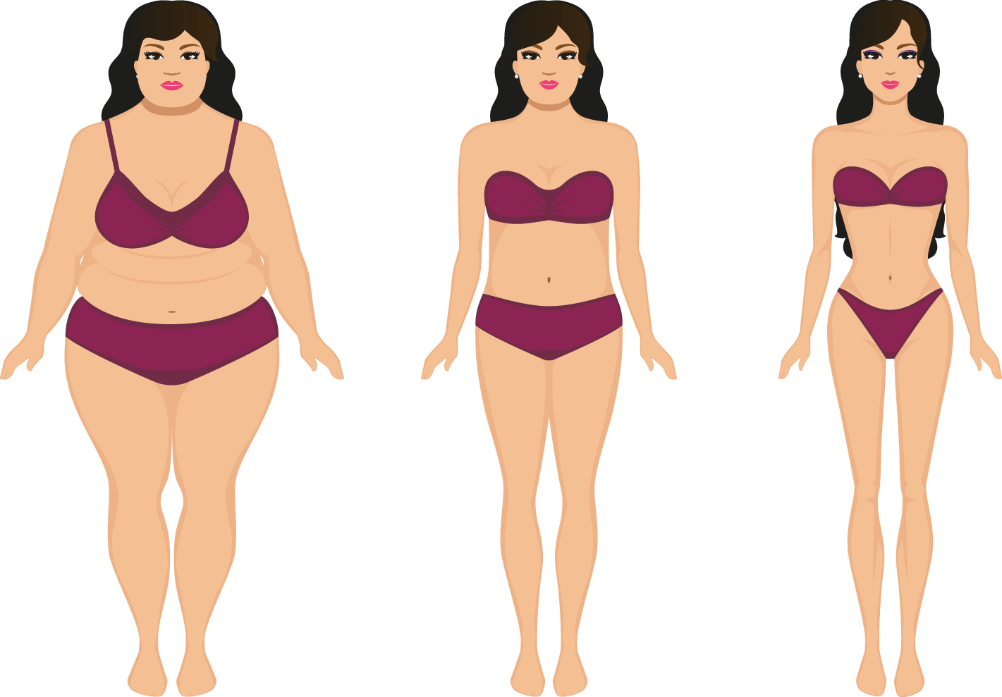 Obese Children (1421x989), Png Download