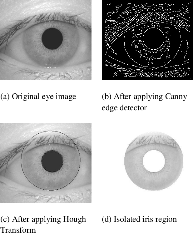 Segmentation Process Of An Iris Recognition System - Segmentation For Iris Recognition (666x785), Png Download