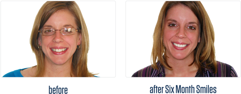 Gallery-16 - Girl (1000x434), Png Download