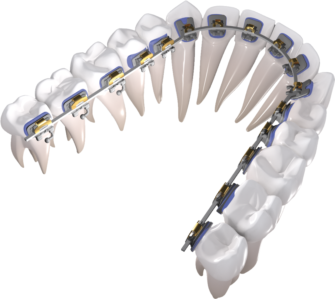 Control From Start To Finish - Bead (1142x1011), Png Download