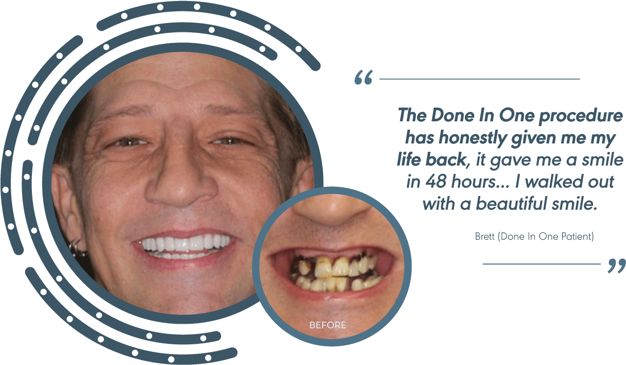 34265946 0 Testimonial Brett 3 - Dental Braces (1320x780), Png Download