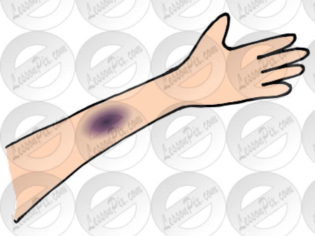 Bruise Clipart Black And White (640x480), Png Download