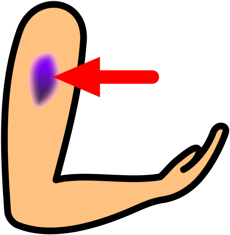 Bruise (800x800), Png Download
