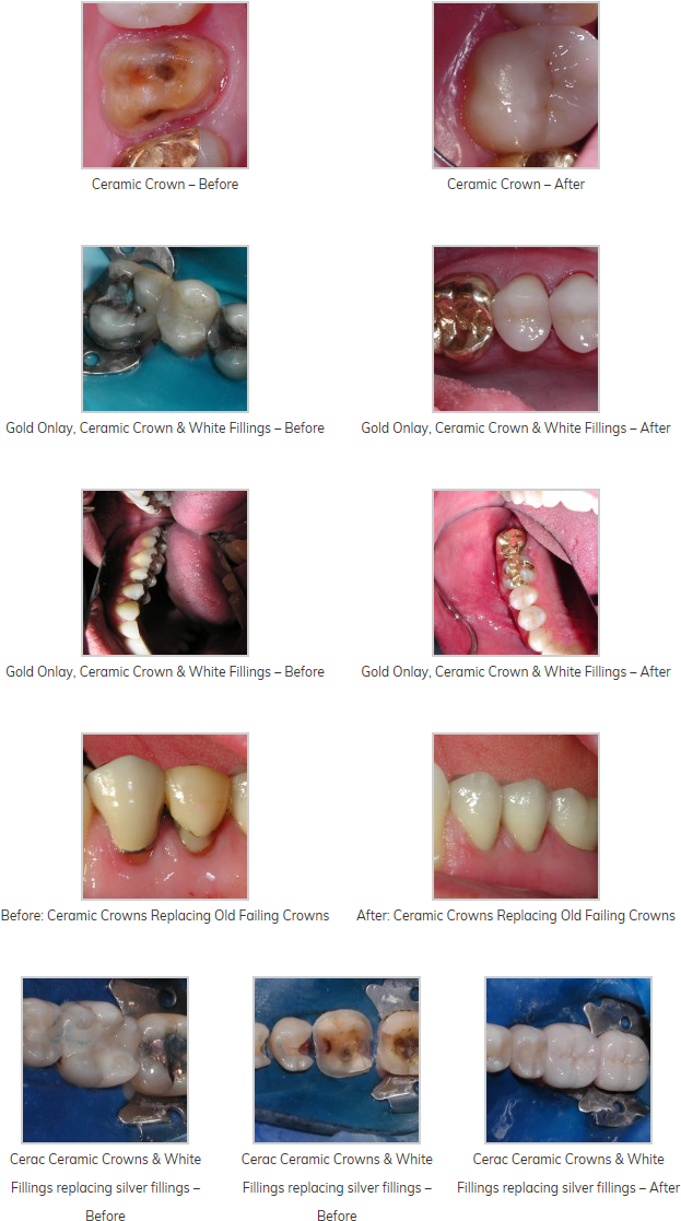 Minimally Invasive Procedure - Jaw (677x1167), Png Download
