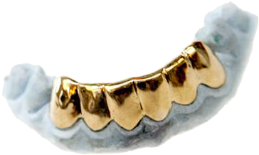 After A Ring Has Been Designed Using The Cad System, - Banana (927x618), Png Download