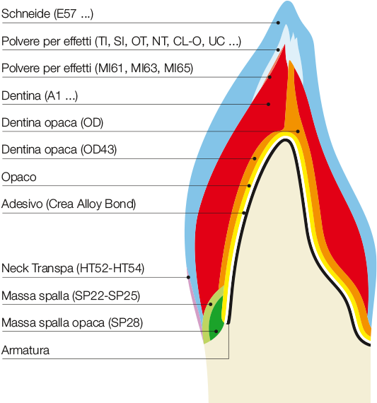 Lf Anwendungsschema It - Massa In Ceramica Dentale (904x587), Png Download