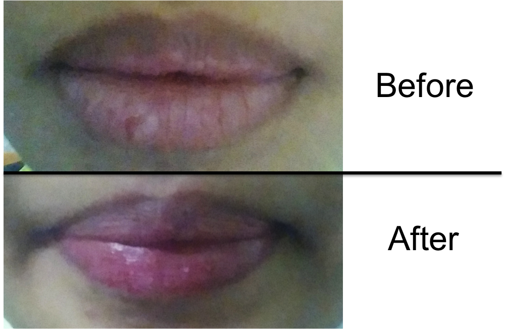 In The After Picture, The Dark Outline Of The Lips - Lip Gloss (1000x651), Png Download